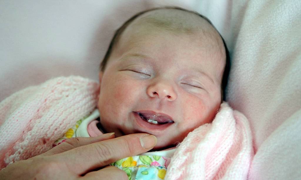 Почему у ребенка в 7 месяцев нет зубов: что делать если не растут, причины