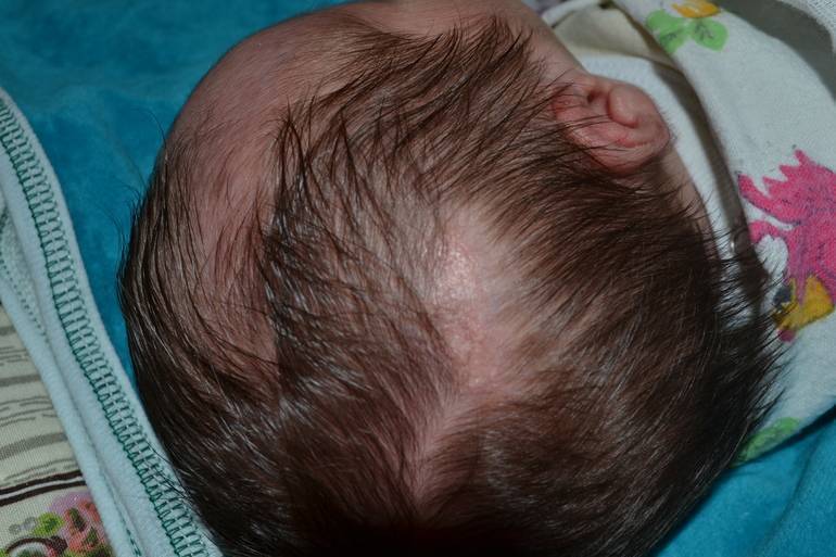 Волосяной покров младенцев: особенности состояния, причины выпадения и правила ухода