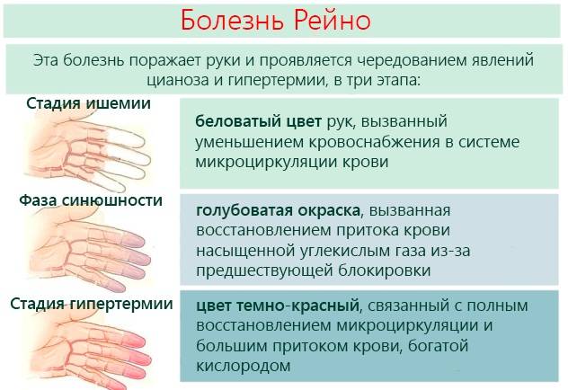Онемение пальцев рук и ног.  к какому врачу обращаться при онемении конечностей