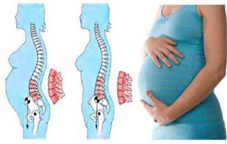 Почему болит спина при беременности