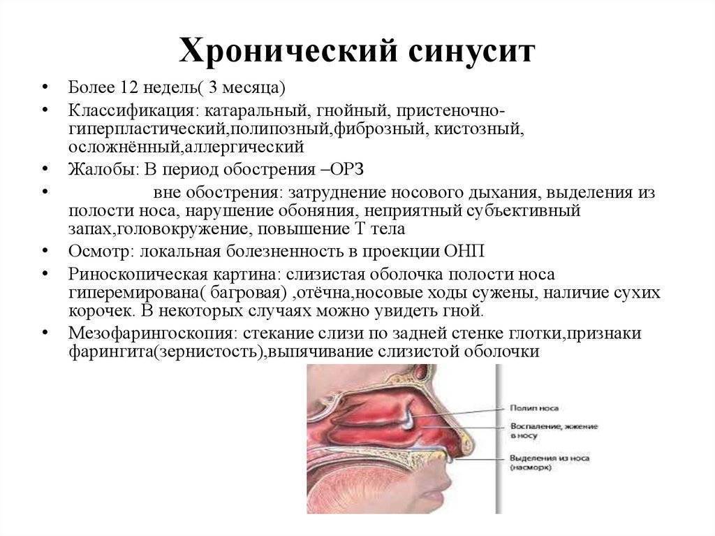 Схема лечения гайморита у взрослых