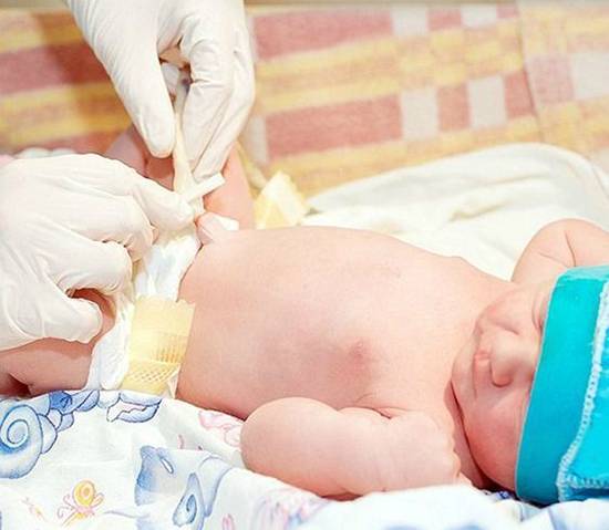 Как обрабатывать пупок новорожденного с прищепкой и без нее
