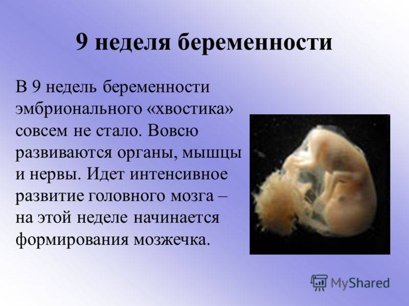 Конец 9 недели. 9 Акушерских недель беременности фото. Девять недель беременности размер плода. Эмбрион в 8-9 недель беременности. Эмбриональный срок 8-9 недель беременности.