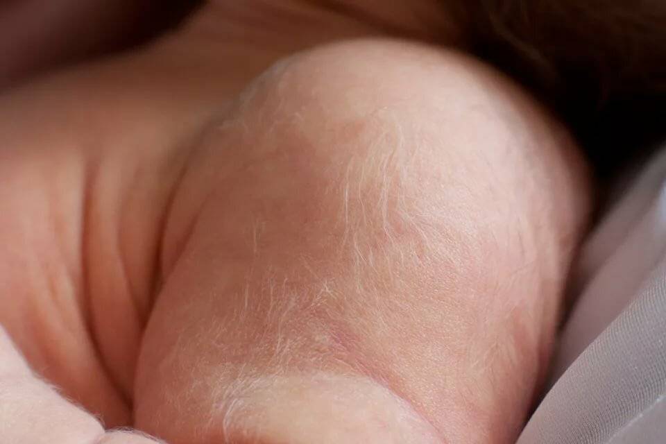Пушковые волосы у новорожденного: причины появления, что с ними делать
