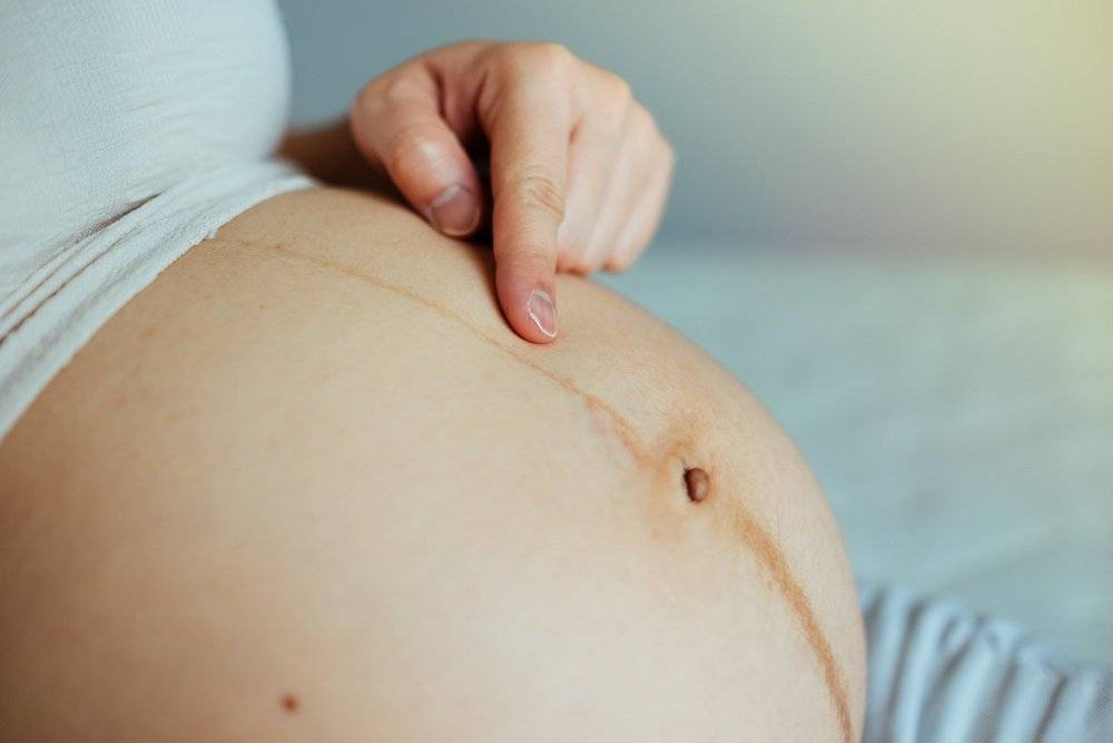 Перхоть при беременности: причины появления, как бороться с перхотью