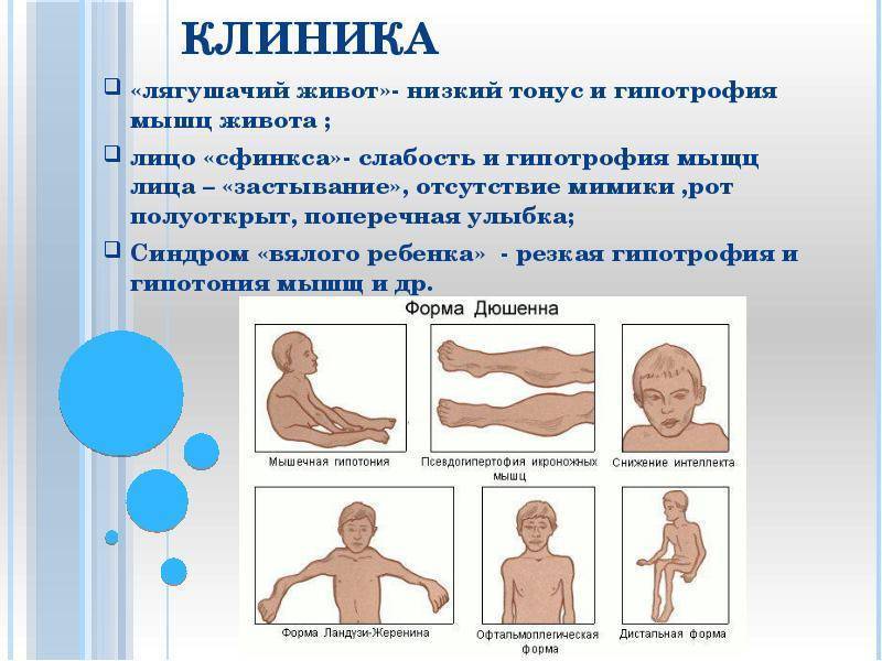 Эффективное лечение гипотонуса мышц у ребенка в оренбурге