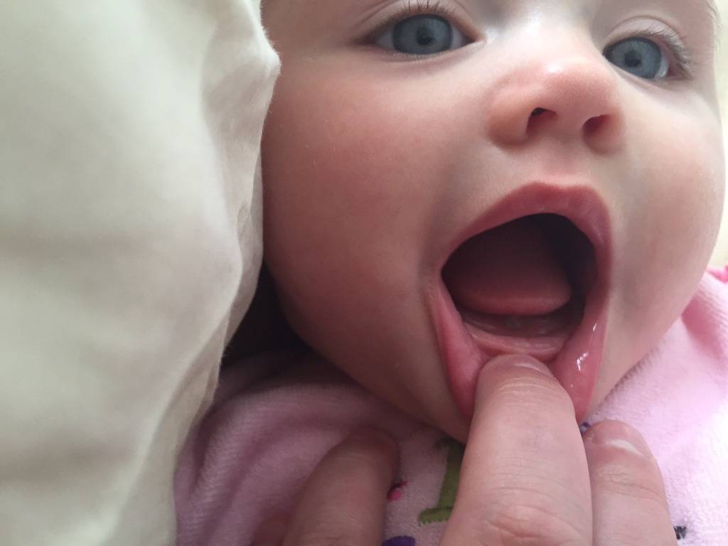 Режутся зубки и клыки у ребенка: определяем и помогаем малышу