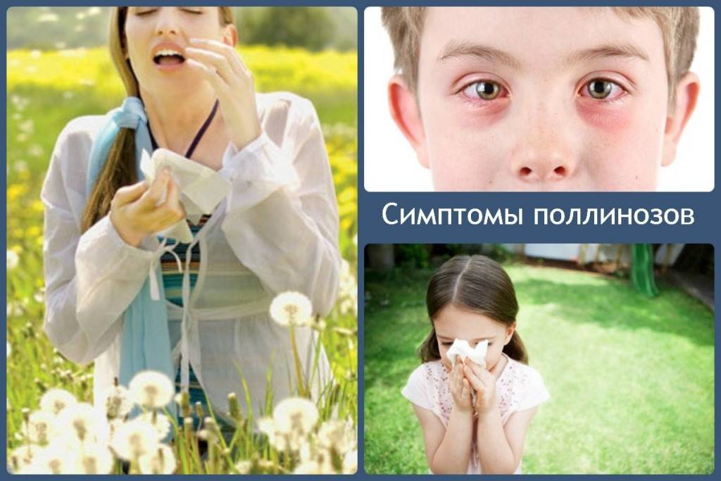 Поллиноз - лечение сенной лихорадки