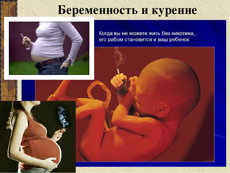 Вред курения во время беременности, чем опасно на разных сроках и последствия