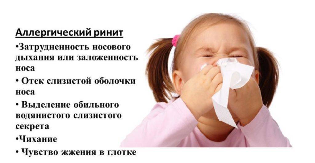 Носовое кровотечение: причины, симптомы, методы лечения