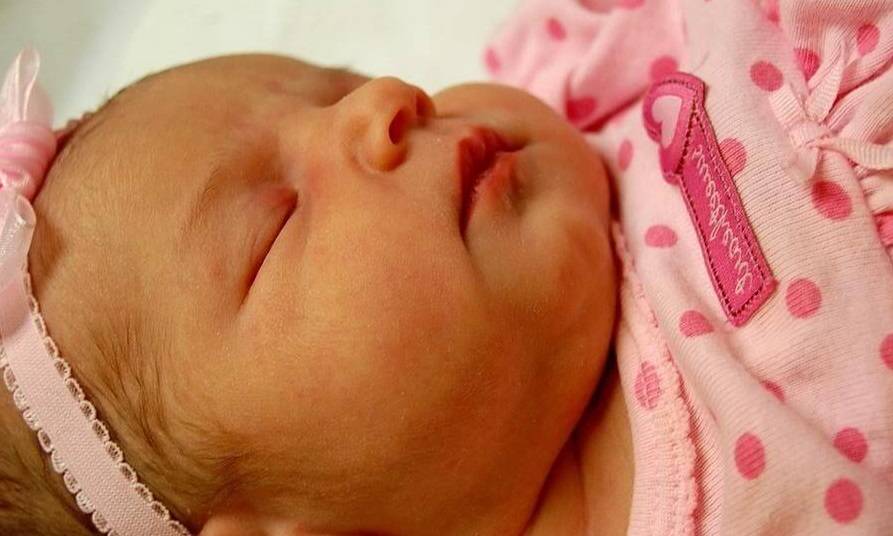 Желтые белки глаз у новорожденного: причины, описание с фото, возможные проблемы и рекомендации педиатров