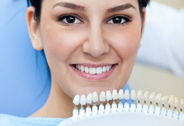 Подготовка к отбеливанию зубов: нужно ли делать чистку зубов, отбеливание зубов в домашних условиях