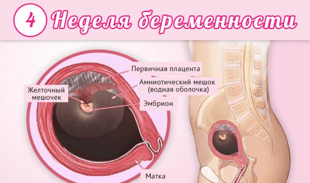 Узи на 4 неделе беременности — решаем вопрос рожать или нет