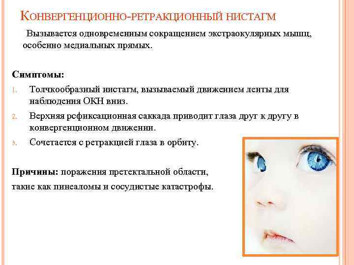 Как лечить расходящееся косоглазие у ребенка? - энциклопедия ochkov.net