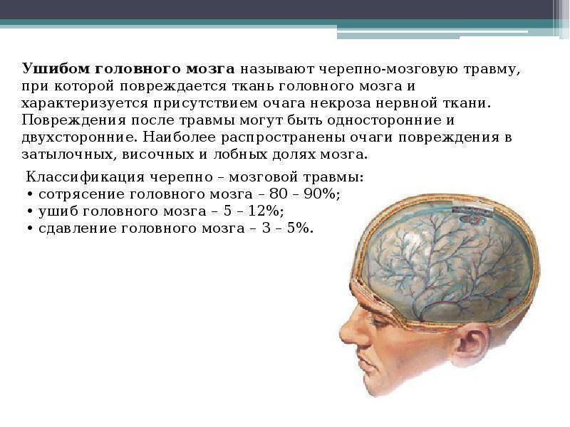 Что такое сотрясение головного мозга