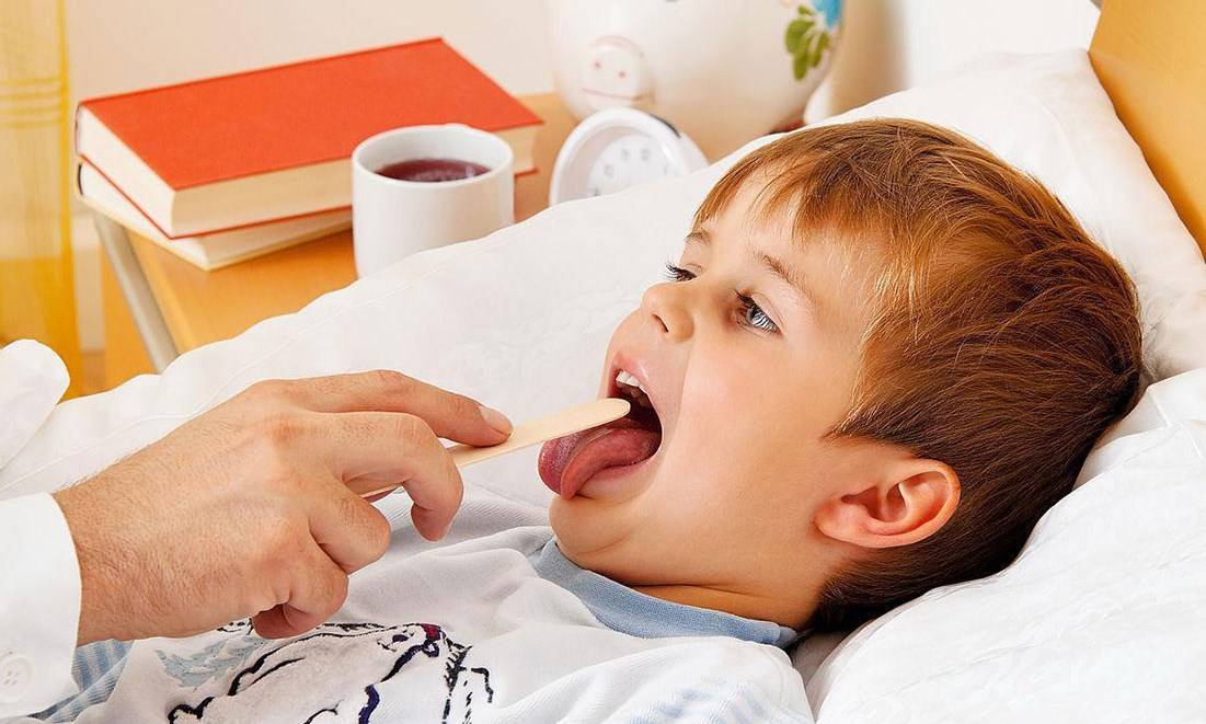 Причины белого налета на языке у ребенка | грудничка, и его лечение