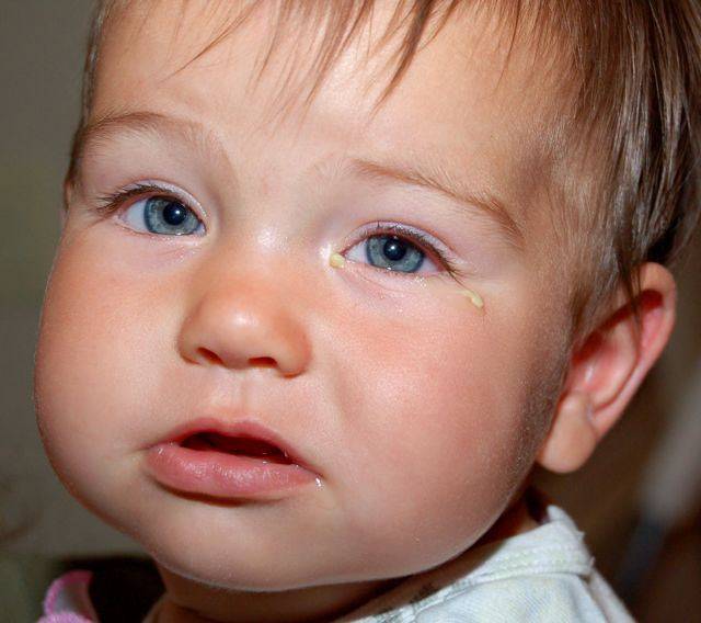 Конъюнктивит у трехмесячного ребенка: что делать? - энциклопедия ochkov.net