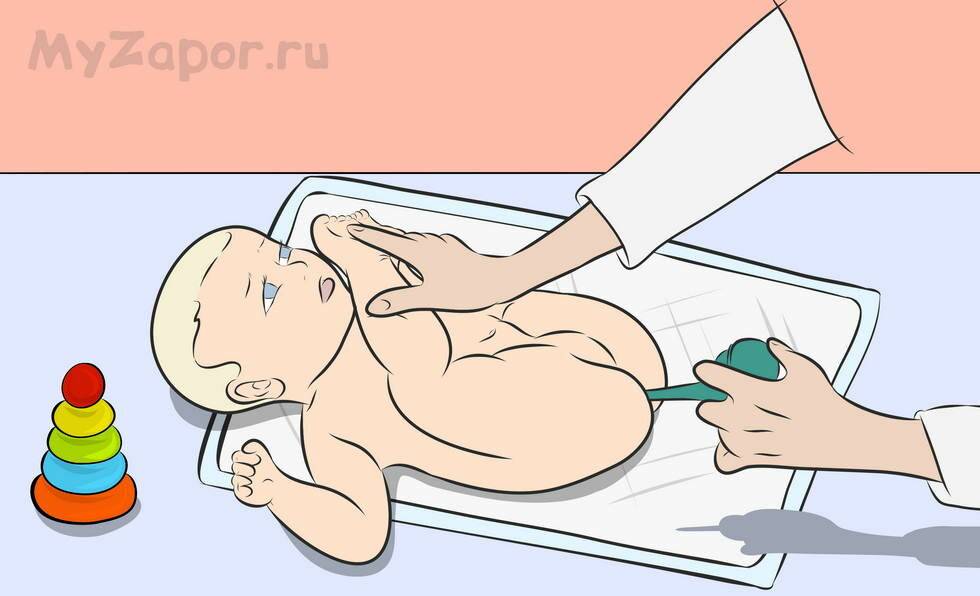 Как часто можно делать клизму младенцу | главный перинатальный - всё про беременность и роды