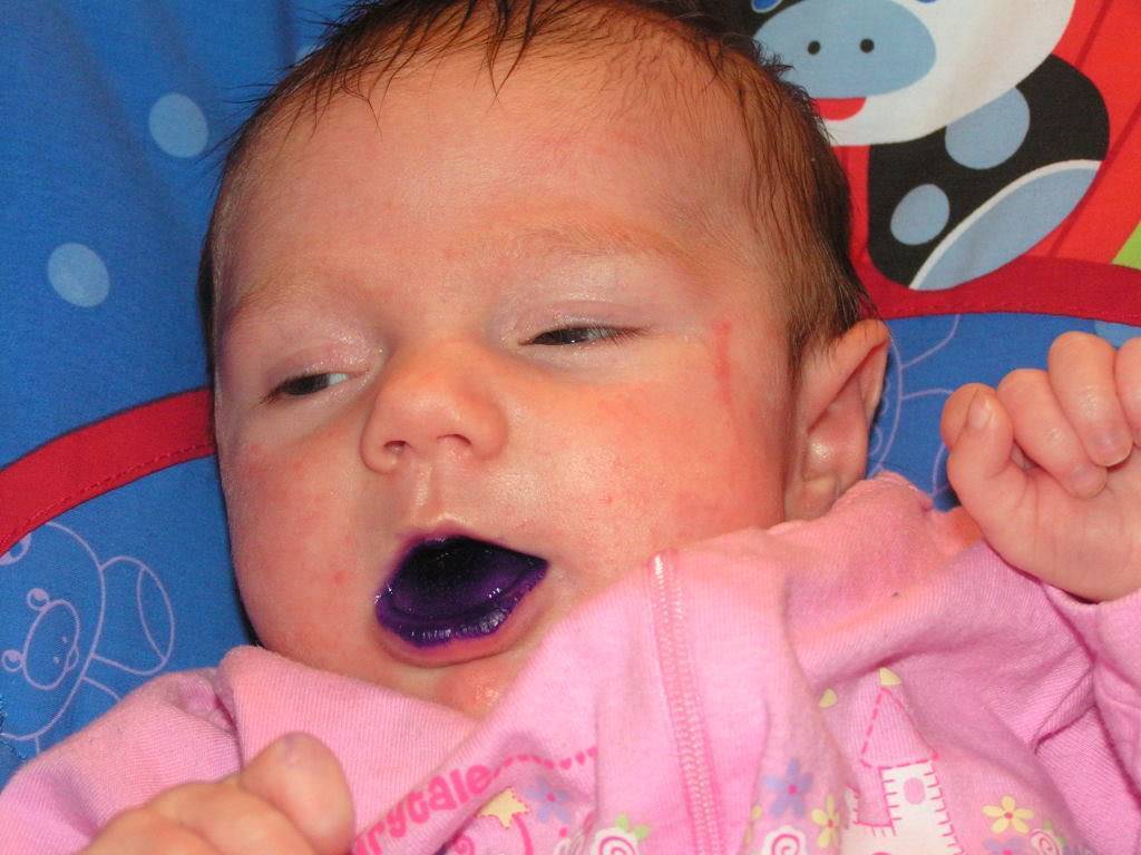 Синие губы у ребенка: причины и возможные осложнения