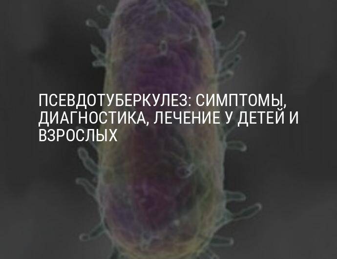 Yersinia pseudotuberculosis, yersinia enterocolitica, igм, полуколичественно: исследования в лаборатории kdlmed