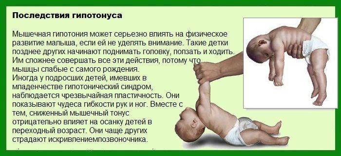 Снятие гипертонуса у ребенка - лечение массажем
