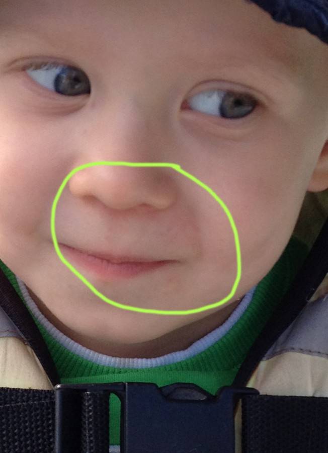 Почему у малыша синеет вокруг рта ~ детская городская поликлиника №1 г. магнитогорска