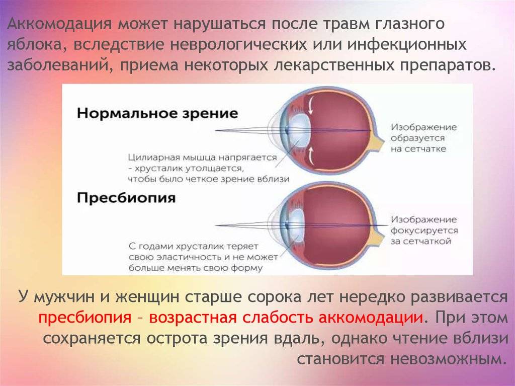 Ложная близорукость. спазм аккомодации – сахалинский центр микрохирургии глаза