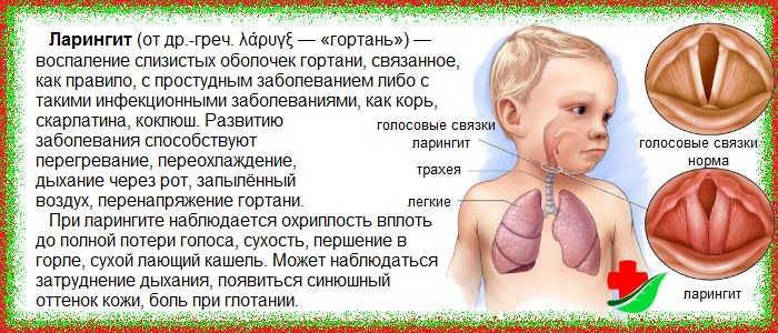 Осиплость голоса с температурой у ребенка: причины, лечение, профилактика — полезные статьи на сайте доктора зайцева