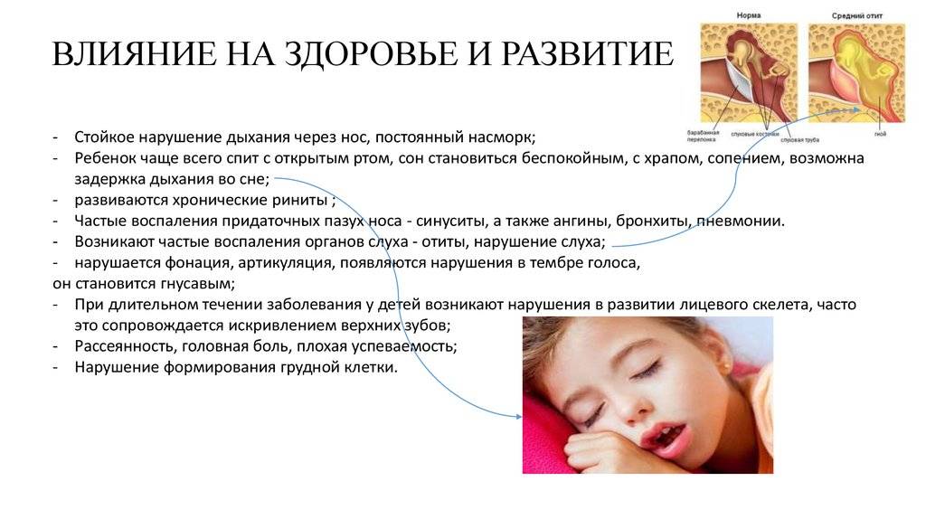 Грудной ребенок во сне задыхается