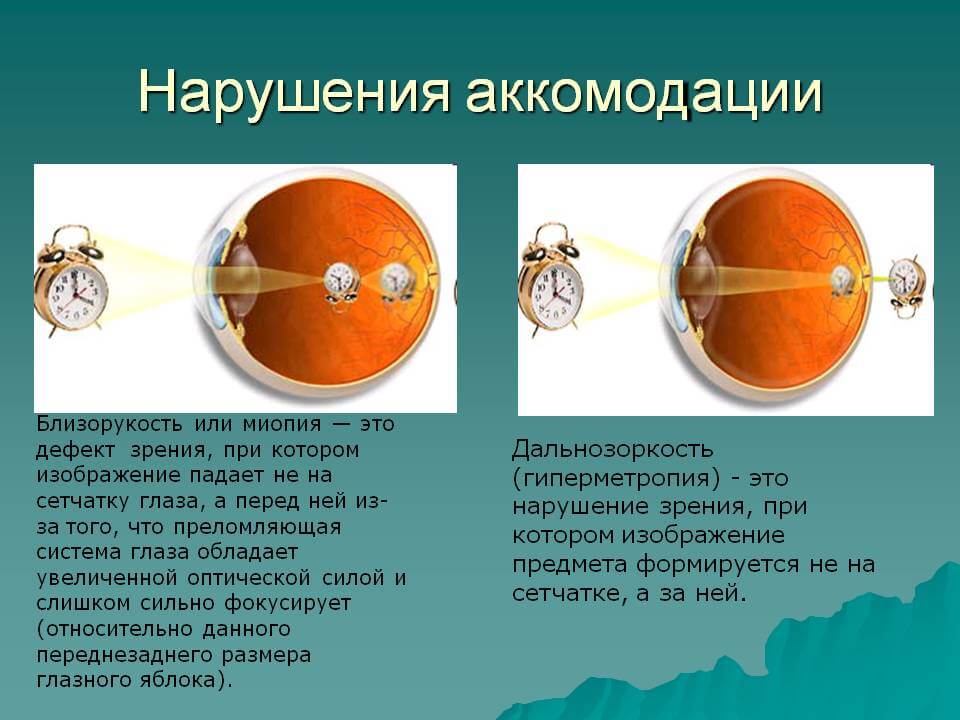 Исследование аккомодации зрения проект