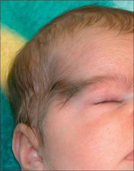 Пушковые волосы у новорожденного: причины появления, что с ними делать