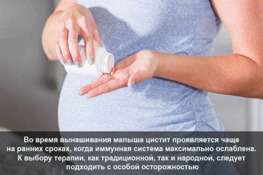 Инфекции мочевыводящих путей у беременных