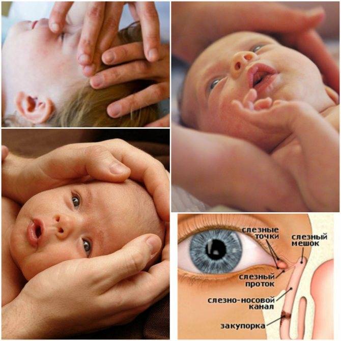 Массаж слёзного канала у новорожденных: 7-ступенчатый алгоритм