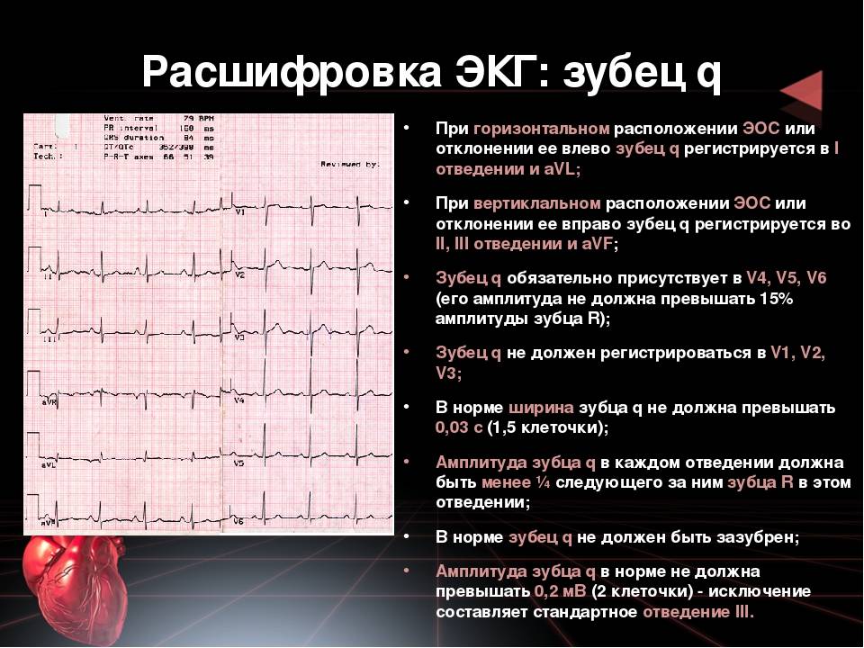 Что значит экг. Расшифровка ЭКГ зубец t. ЭКГ сердца QRS норма. Электрическая ось нормальной электрокардиограммы.. Зубцы q r s t ЭКГ.