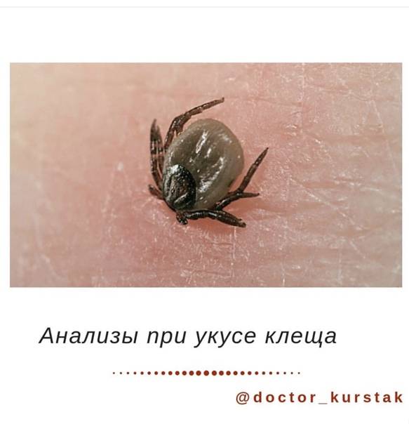Может ли укус клеща отяготить течение коронавирусной инфекции?