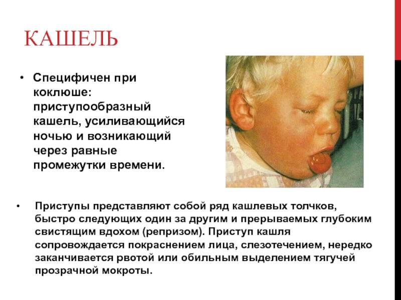 Мокрый кашель у ребенка: 4 главные причины, 5 способов лечения от врача-педиатра