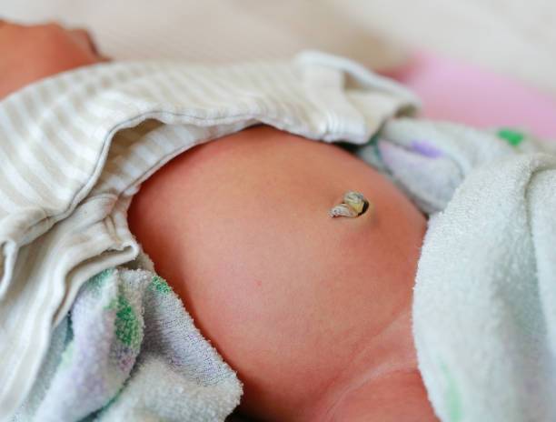 Рекомендации по правильному уходу за пупочной ранкой у новорожденных