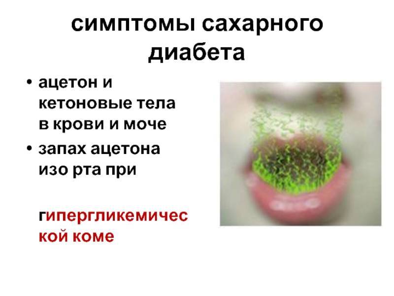 Запах ацетона изо рта – причины и что это значит?