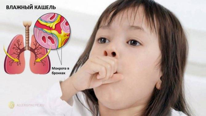Аллергический кашель у ребенка: 4 вида, 5 симптомов, лечение, как распознать, видео