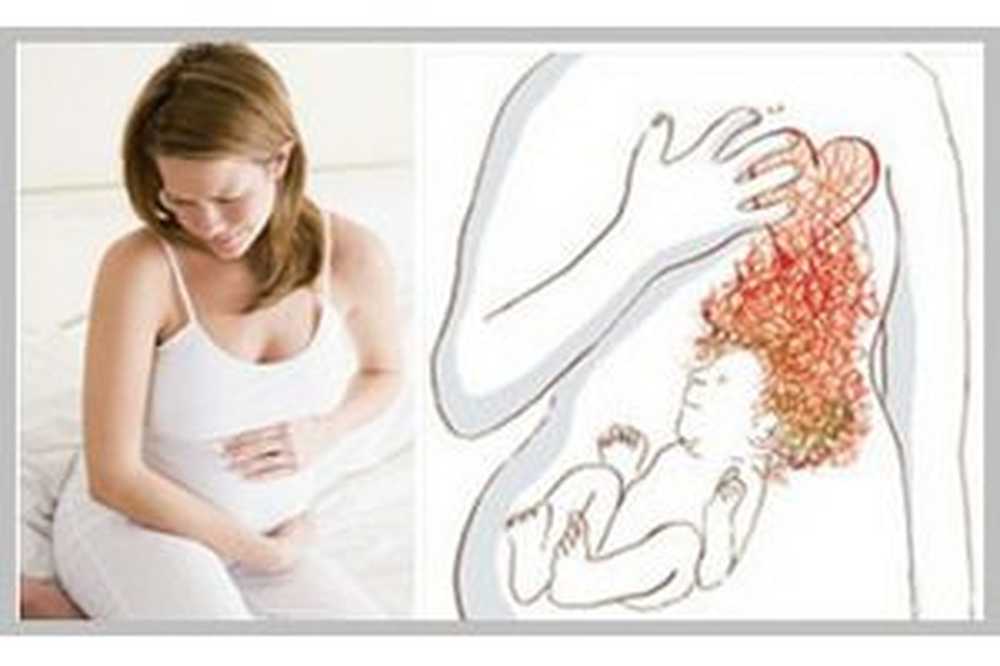 Отёки во время беременности