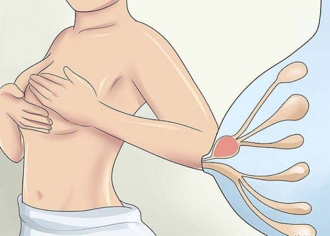 Массаж груди при застое: как выкормить ребенка и сохранить грудь здоровой?