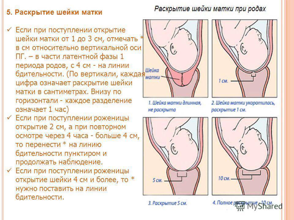 Внутриматочная инсеминация: как проходит - статья репродуктивного центра «за рождение»