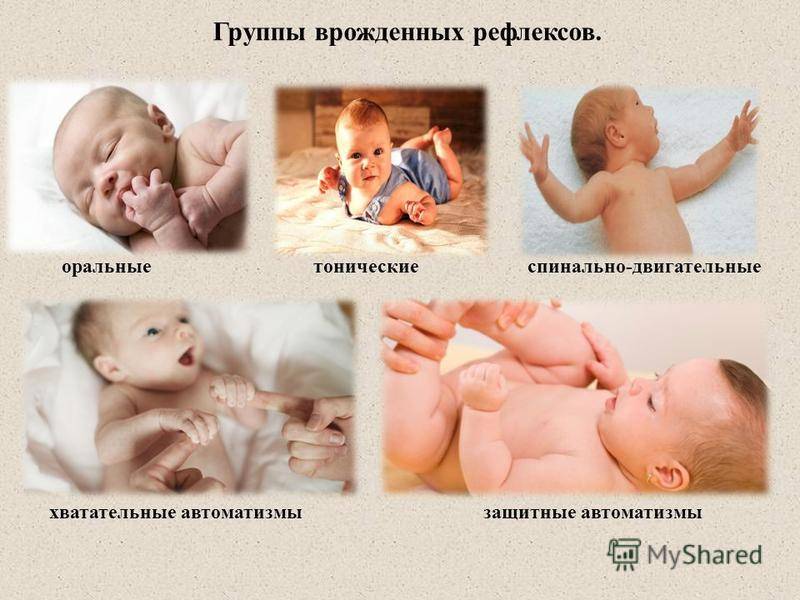 Рефлексы новорожденных (безусловные, условные, врожденные)