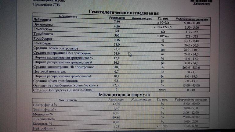 Иммуноглобулин аллергия норма. Показатели крови иммуноглобулин е общий анализ. Анализ крови иммуноглобулин е расшифровка у детей норма. IGE анализ крови расшифровка. Иммуноглобулин анализ крови расшифровка.