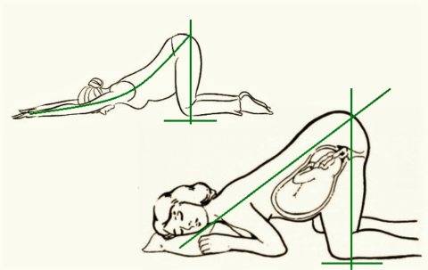 Коленно-локтевое положение при беременности: как правильно делать, фото позиции, польза для матери и плода, рекомендации, эффективность
