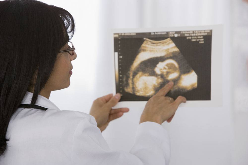 Многоводие при беременности - медицинский портал eurolab