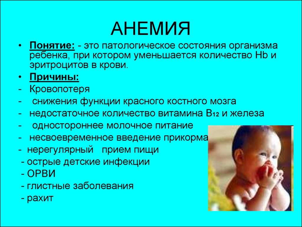 Анемия у детей: причины, симптомы, лечение