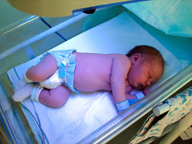 Пожелтение новорожденных детей: почему это происходит, насколько опасно для малыша