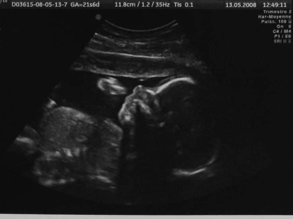 22 неделя беременности :: polismed.com
