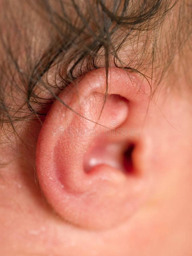 Деформация ушной раковины: причины, симптомы, диагностика и лечение